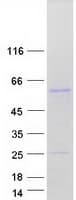 Human EDAR Protein (Recombinant Myc-DDK (Flag))