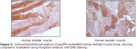 Monoclonal Mouse anti-Human MB / Myoglobin Antibody (clone 6H8B5, 5A2G8, 4D7H3, 3H6A7, IHC, WB)