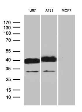Monoclonal Mouse anti-Human PDPN / Podoplanin Antibody (clone OTI3H5, aa23-131, IHC, WB)