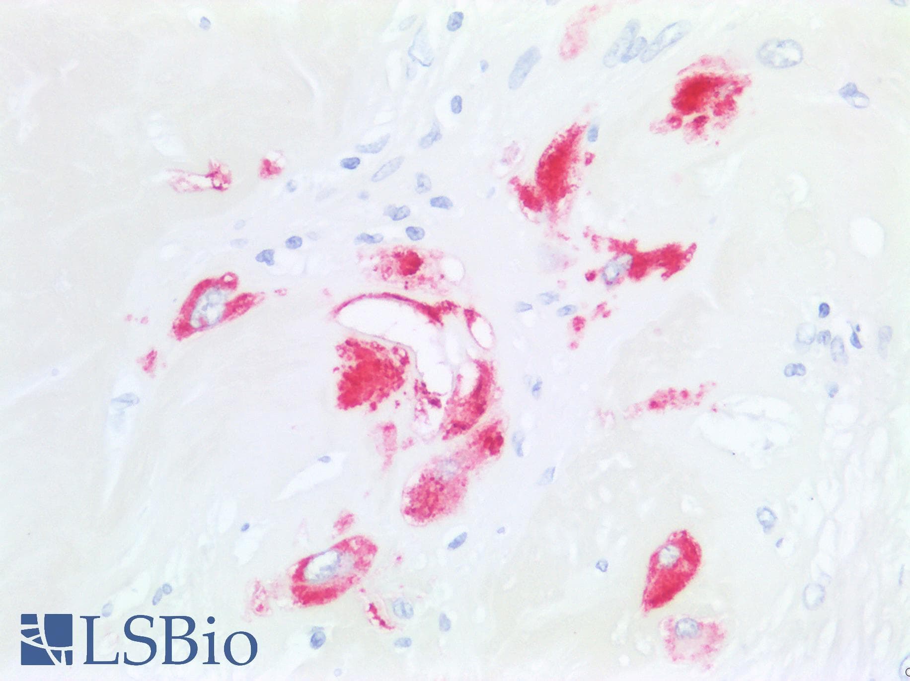 PathPlus™ Placental Lactogen Antibody