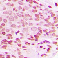 JUN / c-Jun Antibody (phospho-Thr93)