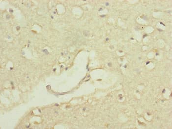 Polyclonal Rabbit anti-Human POP4 Antibody (IHC)