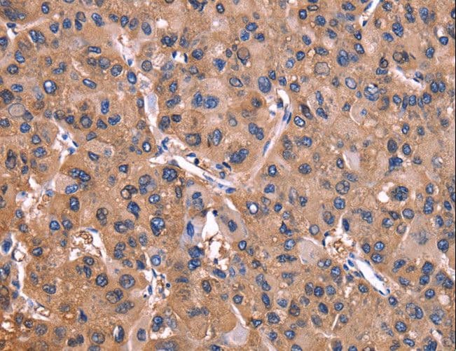 Polyclonal Rabbit anti-Human ADM2 / Adrenomedullin 2 Antibody (IHC)