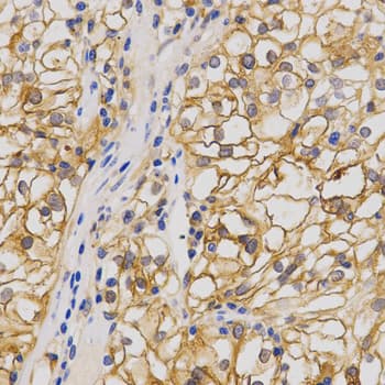 GRIA1 / GLUR1 Antibody