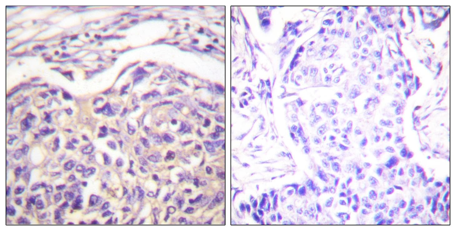 Polyclonal Rabbit anti-Human Tuberin / TSC2 Antibody (Ab-1462, IHC)