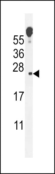 VOPP1 / ECOP Antibody (aa65-95)