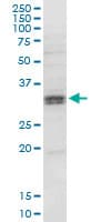 HSD11B1 / HSD11B Antibody (clone 2C10)