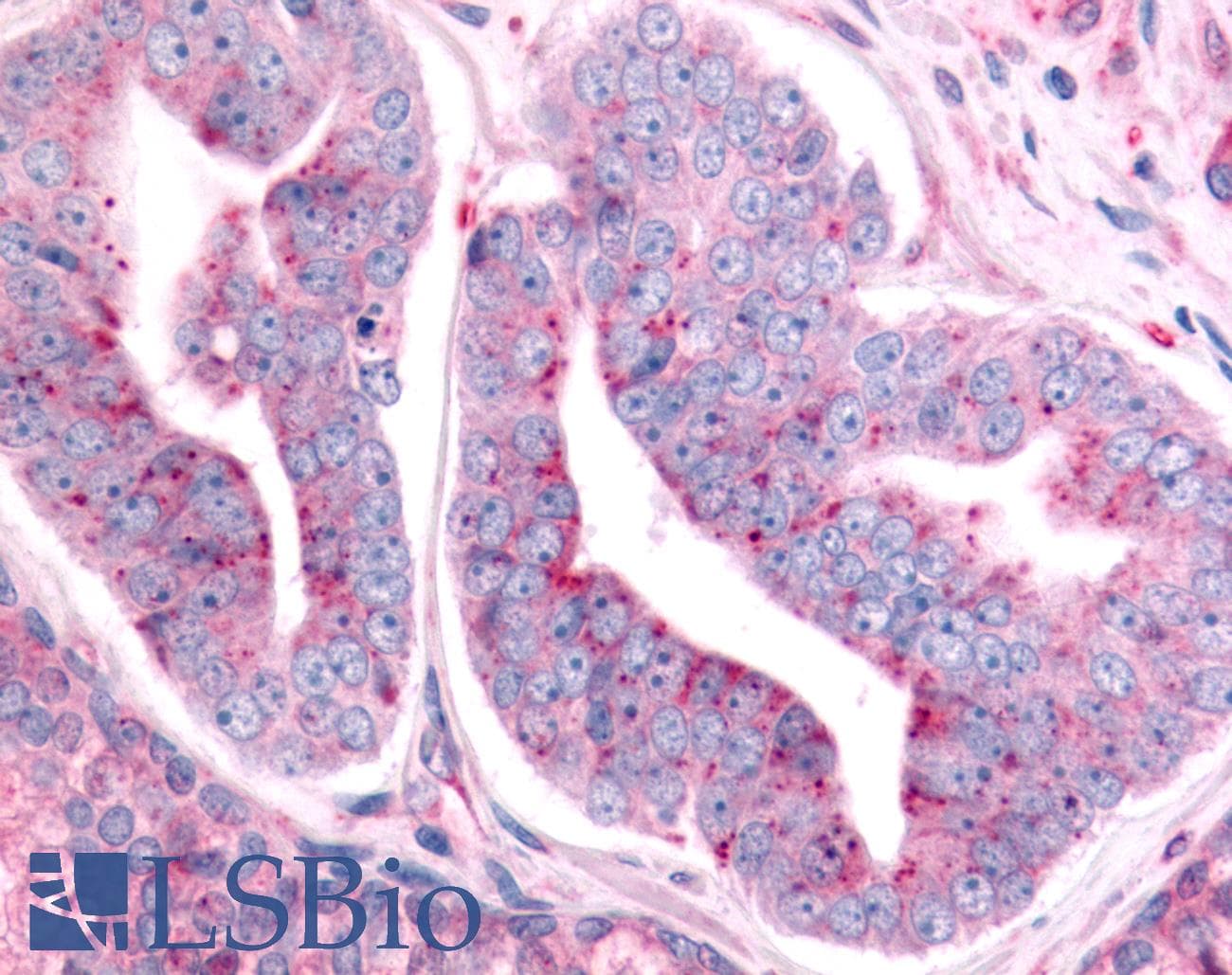 PathPlus™ PTPRE / PTP Epsilon Antibody (Cytoplasmic Domain)