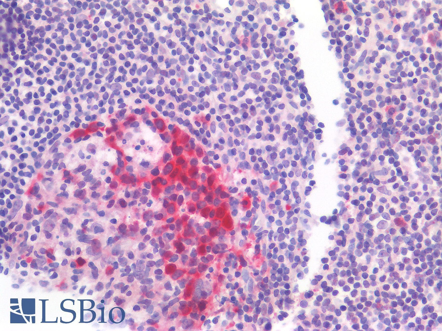 IHC-plus™ TS / Thymidylate Synthase Antibody (clone OTI2C3)