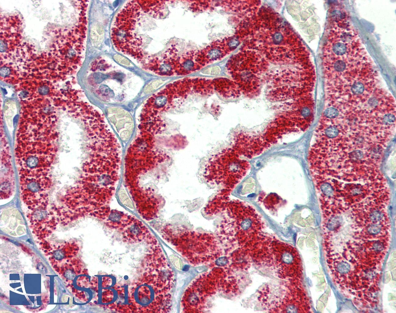 SH3BP2 Antibody (aa432-481)