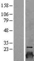 Human CLDN3 / Claudin 3 Protein (Over-Expression Lysate Myc-DDK (Flag))