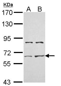 IHC-plus™ ACVR2 / ACVR2A Antibody (aa267-513)