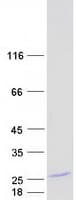 Human MBP / Myelin Basic Protein (Recombinant Myc-DDK (Flag))