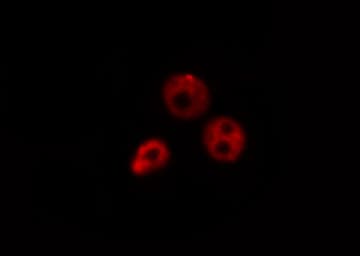 TFE3 Antibody