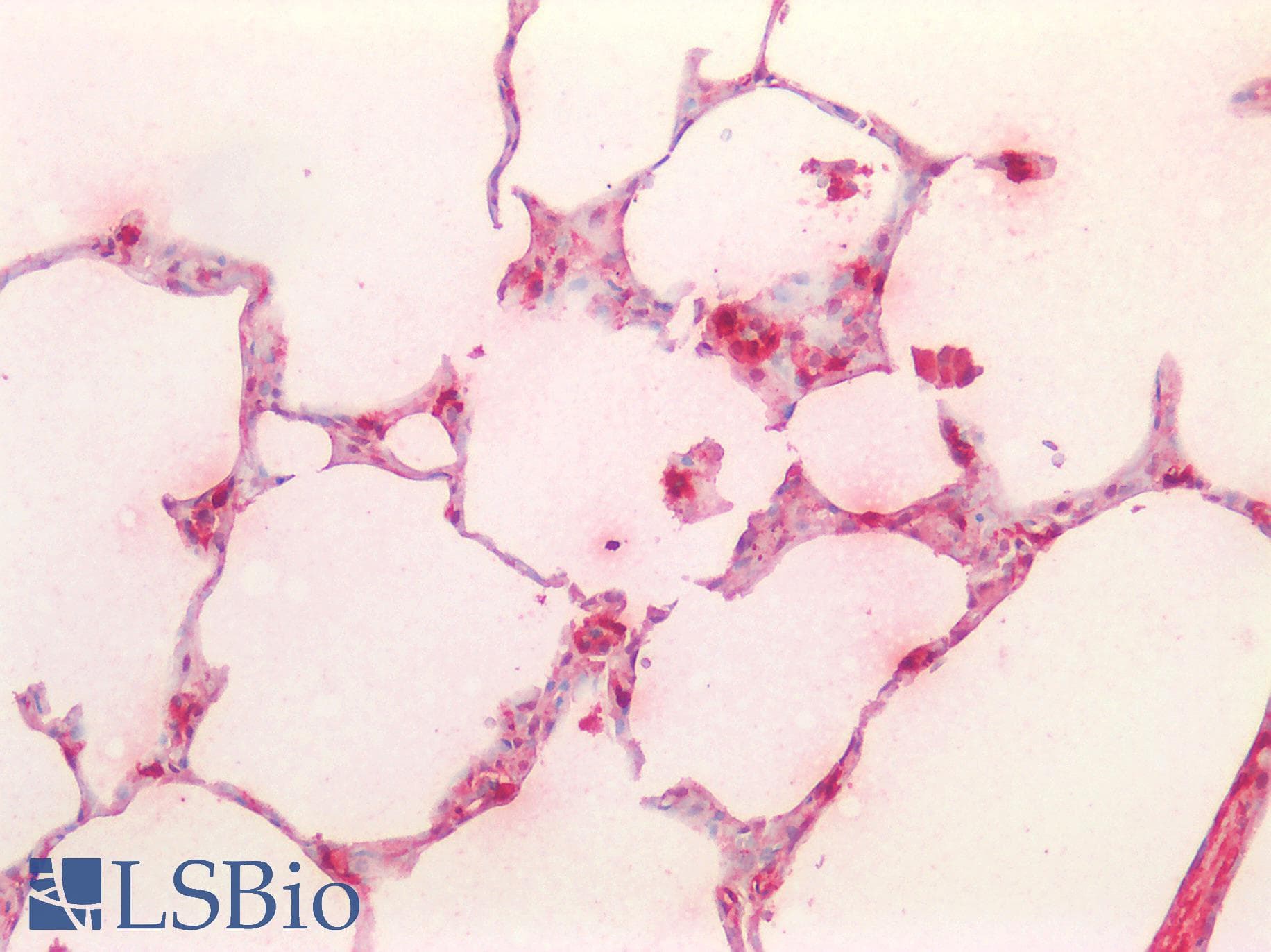 TPSAB1 / Mast Cell Tryptase Antibody (clone C16)
