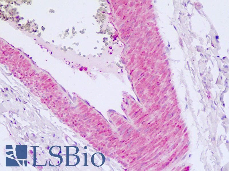 PathPlus™ Polyclonal Rabbit anti-Human F2RL1 / PAR2 Antibody (C-Terminus, IHC)