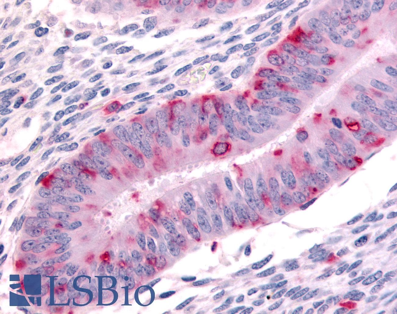 IHC-plus™ Polyclonal Rabbit anti-Human Dipeptidylpeptidase 8 / DPP8 Antibody (N-Terminus, IHC)