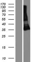 TMIGD1 Protein (Over-Expression Lysate Myc-DDK (Flag))