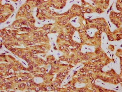 PAR6B / PARD6B Antibody