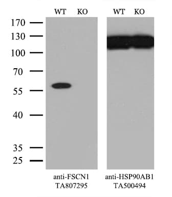 FSCN1 / Fascin Antibody (clone OTI3D2)