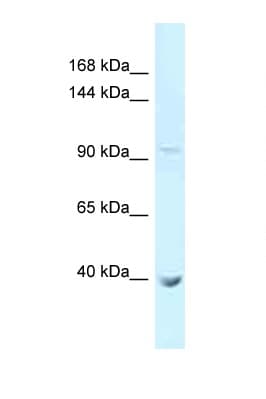 Polyclonal Rabbit anti-Human PCDHA11 Antibody (aa171-220, WB)