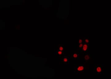 Polyclonal Rabbit anti-Human IRX1 Antibody (IF, WB)