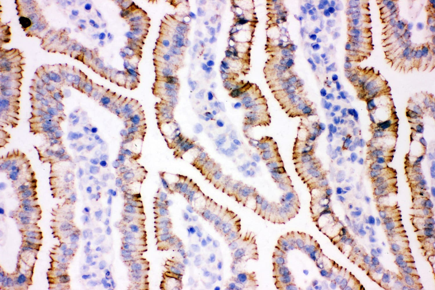 JUP/CTNNG/Junction Plakoglobin Antibody (aa556-745)
