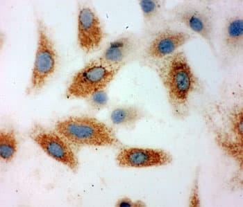 Polyclonal Rabbit anti-Human CDH3 / P-Cadherin Antibody (aa612-626, IHC, WB)
