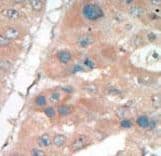 CDKN1A / WAF1 / p21 Antibody (aa134-164)