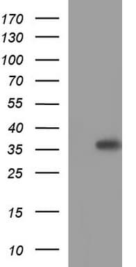 HORMAD2 Antibody (clone OTI2E2)
