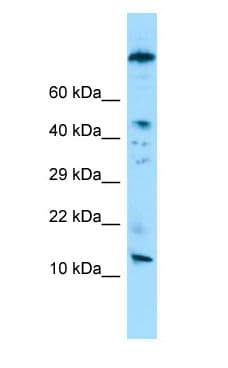 Polyclonal Rabbit anti-Human VCY Antibody (aa20-69, WB)