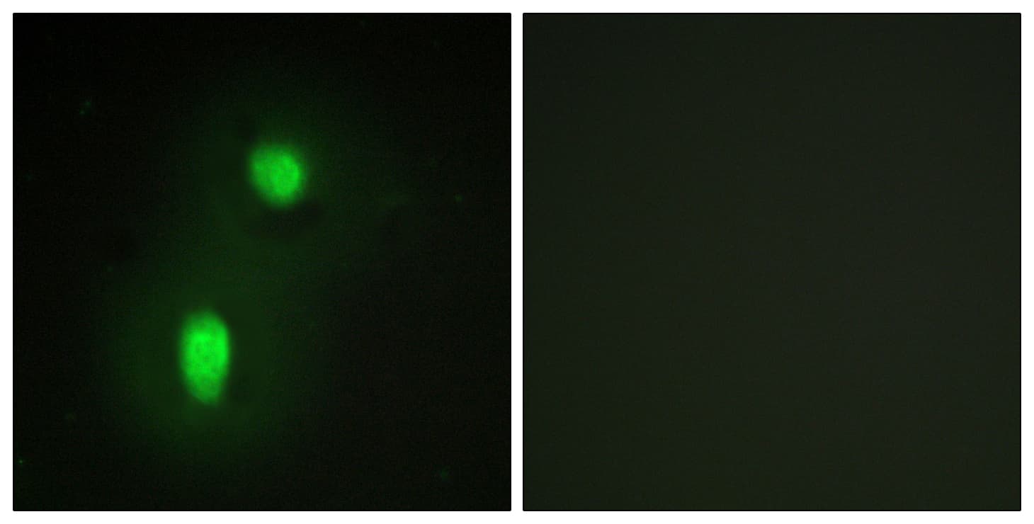 IHC-plus™ HNRNPC / HNRNP C Antibody (aa241-290)