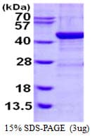 Human ADH1C Protein (Recombinant His)