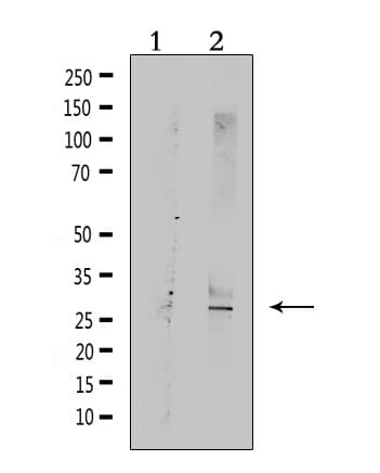 Polyclonal Rabbit anti-Human TRAIL-R3 / DCR1 Antibody (IHC, WB)