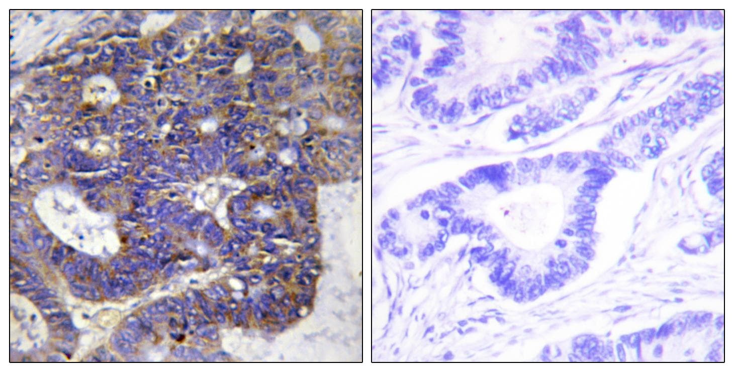 Polyclonal Rabbit anti-Human COL4A2 / Collagen IV Alpha2 Antibody (IHC, IF, WB)