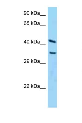 ADPRH / ARH1 Antibody (C-Terminus)