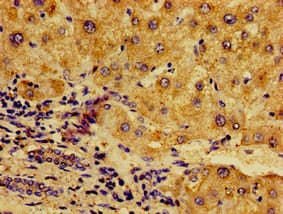 NFKB2 Antibody