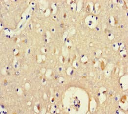 Polyclonal Rabbit anti-Human BEX5 Antibody
