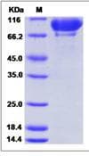 Mouse Complement C2 Protein (Recombinant His,C-terminus)