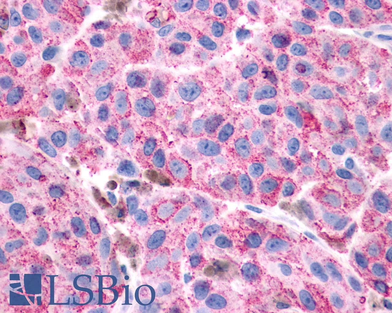 IHC-plus™ VIPR1 Antibody (Cytoplasmic Domain)