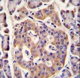 PLD5 / Phospholipase D5 Antibody (aa508-536)