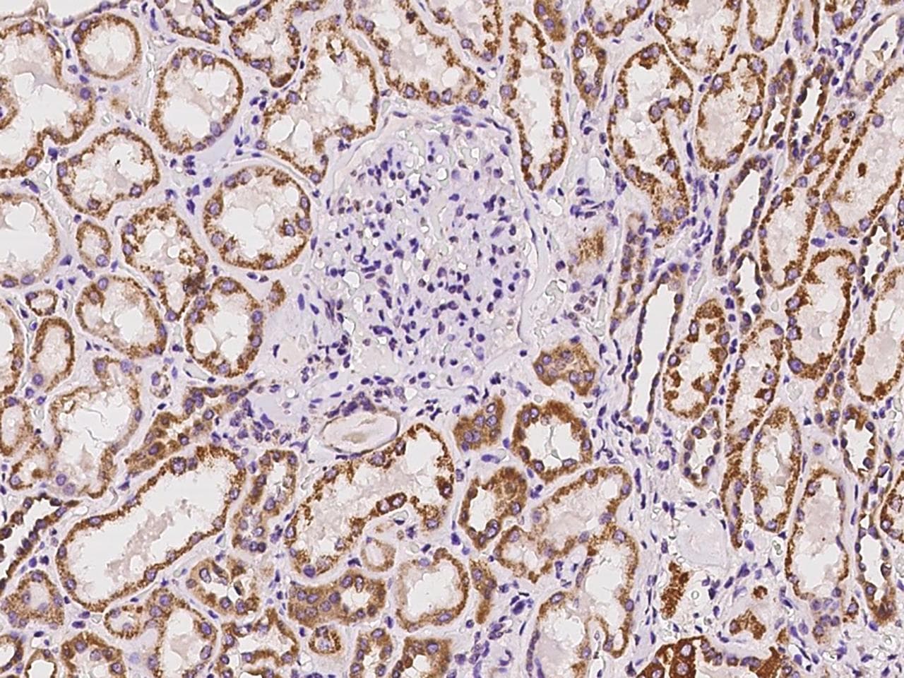 Polyclonal Rabbit anti-Human ABCC11 / MRP8 Antibody (IHC)