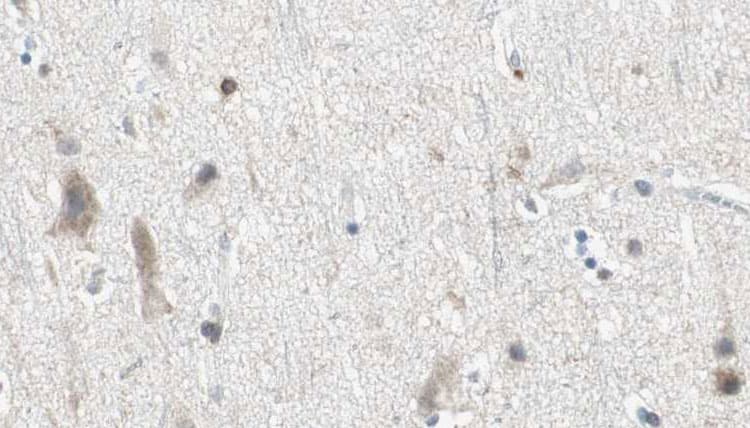 Polyclonal Rabbit anti-Human DZIP3 Antibody (IHC, IF, WB)