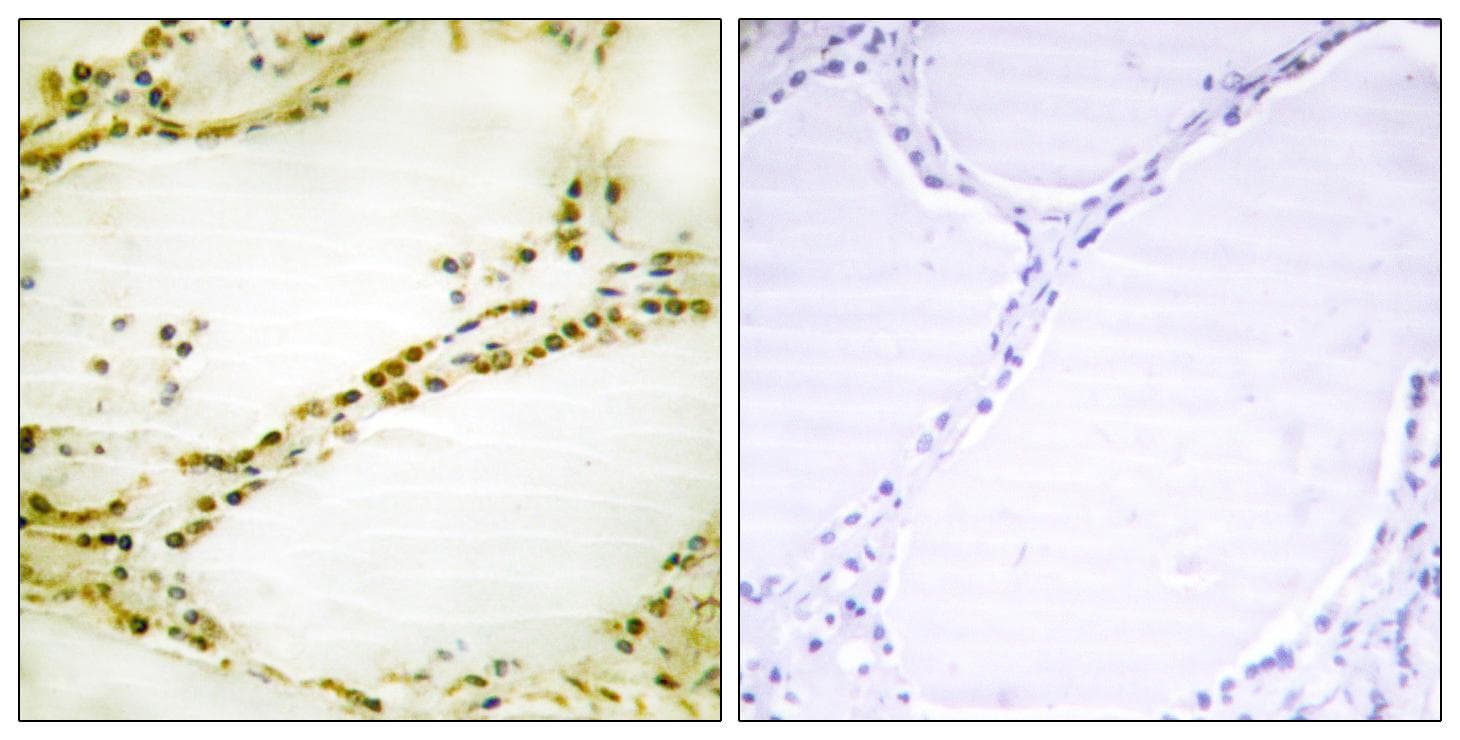 Polyclonal Rabbit anti-Human RGS16 Antibody (Ab-168, IHC, IF)