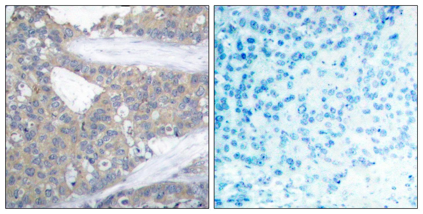 PXN / Paxillin Antibody (p31)
