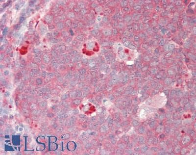 IHC-plus™ Polyclonal Rabbit anti-Human CAD Antibody (aa1850-2000, IHC, WB)