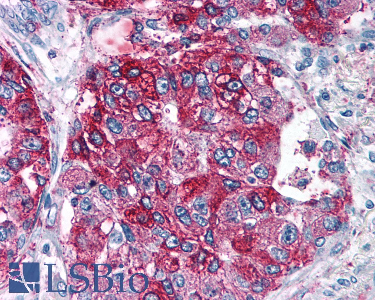 PathPlus™ NPY5R Antibody (Cytoplasmic Domain)