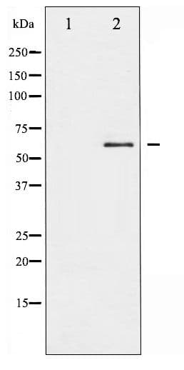 SRC Antibody (phospho-Tyr418)