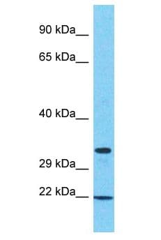 Polyclonal Rabbit anti-Human SAMD10 Antibody (aa33-82, WB)