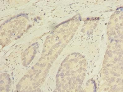 SSMEM1 / C7orf45 Antibody